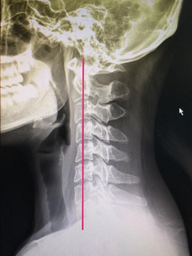 AI助力体检行业升级，提高诊断效率